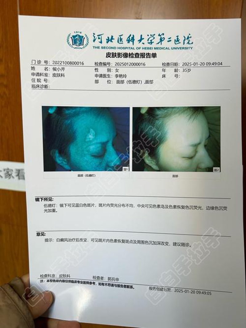 解读中国白癜风专科医院的发展趋势与现状